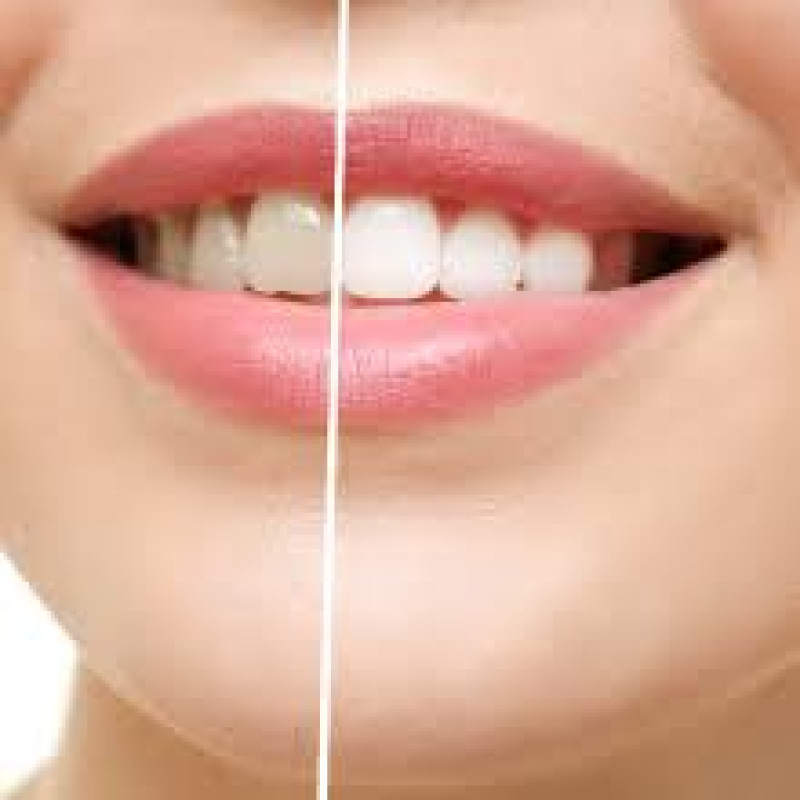 GLODENT - Herbal Tooth Powder .